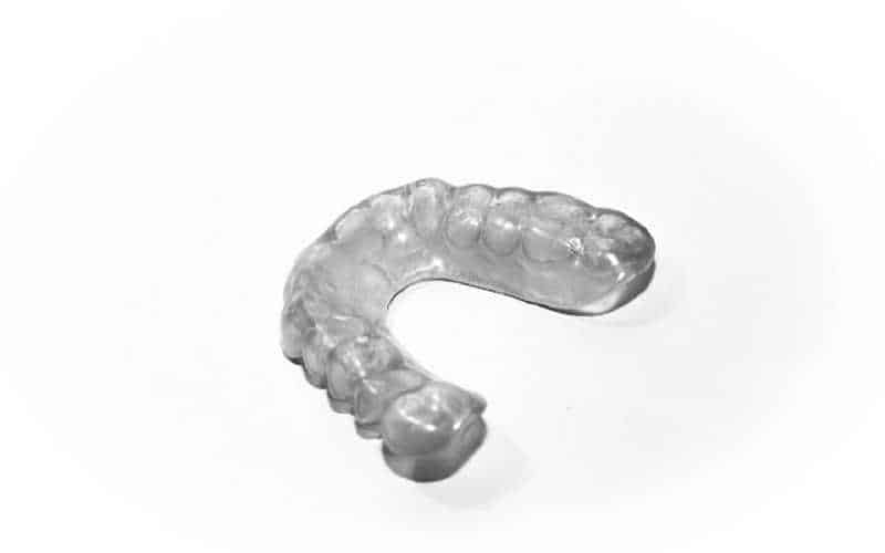 Mitos e verdades sobre o aparelho dentário invisível